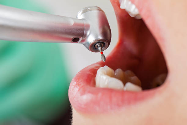 Best Emergency Denture Repair in Center, TX